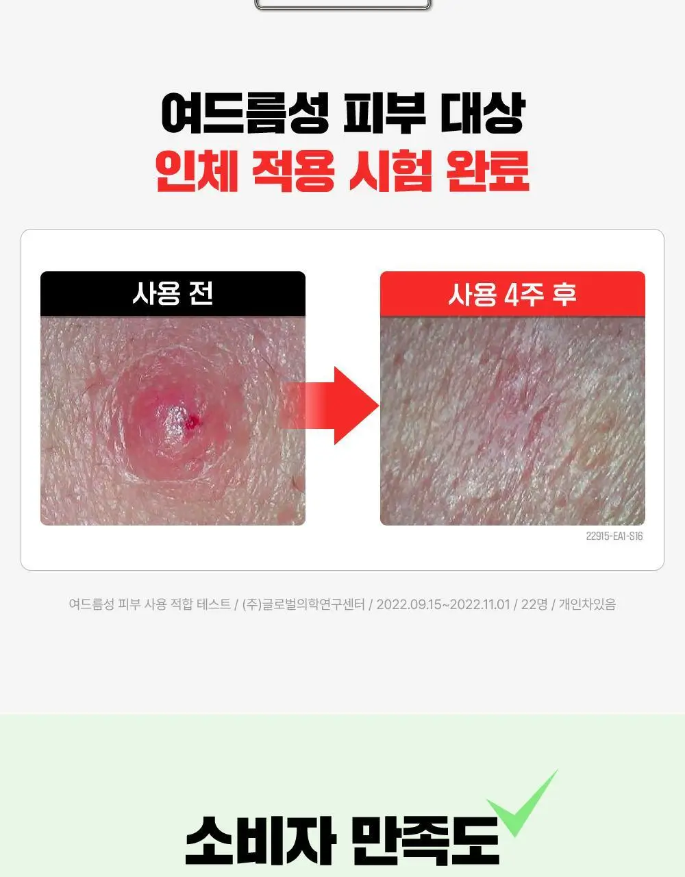 [초슬림] 파티온 노스카나인 트러블케어 스팟패치 102매 상세페이지 7